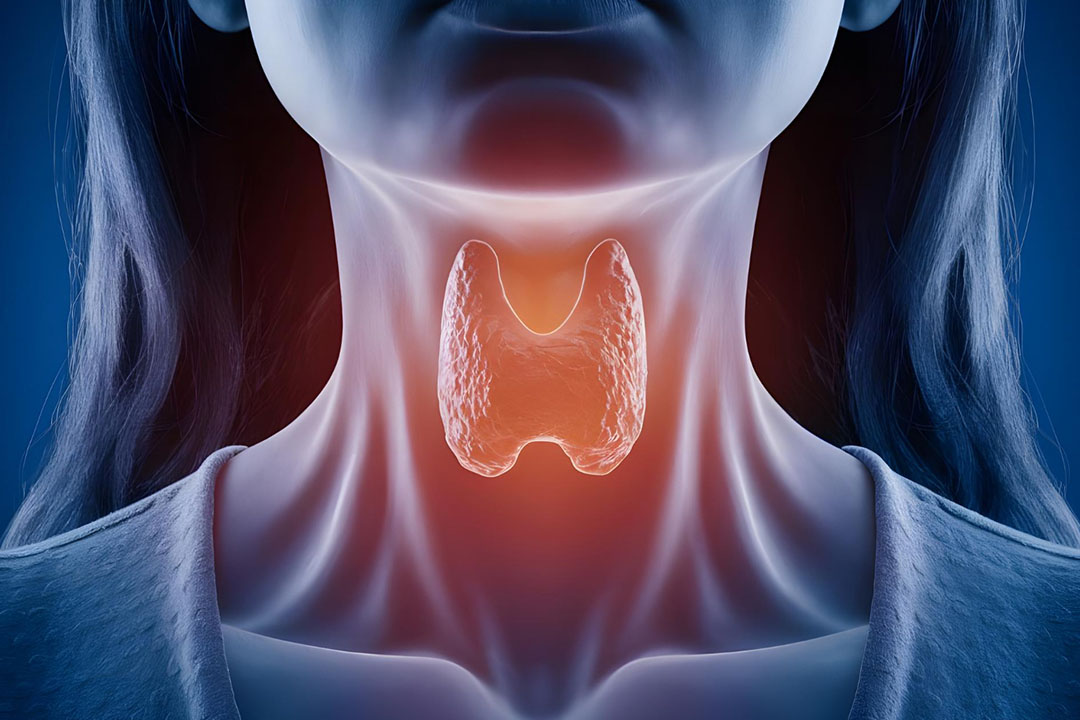 Thyroid Disorders